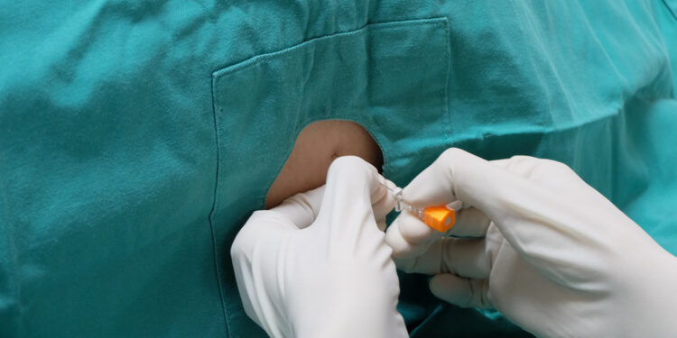 Smegenų skysčio pasėlis