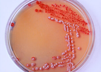 Įprastinis skreplių pasėlis