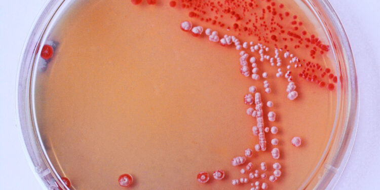 Įprastinis skreplių pasėlis