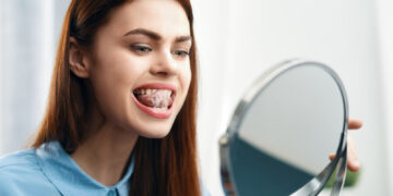 Laikini liežuvio spuogeliai (laikinė liežuvio papilito forma)