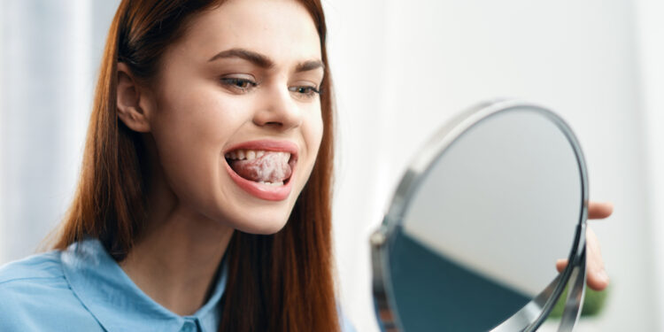 Laikini liežuvio spuogeliai (laikinė liežuvio papilito forma)