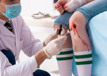 Tinkamas nubrozdintos kelio vietos gydymas