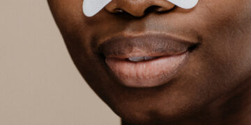 Kas yra balta masė, išsiskirianti spaudžiant nosies poras?