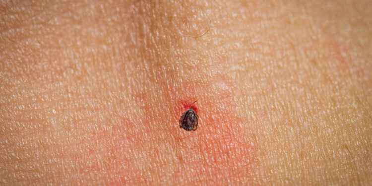 Kraujuojantis apgamas: ar verta sunerimti?