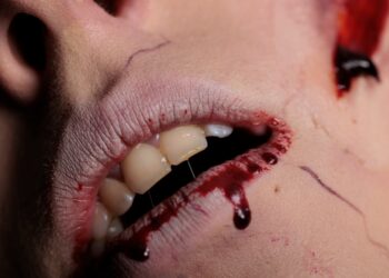 Kodėl mano seilėse yra kraujo?