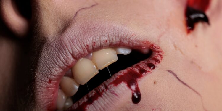 Kodėl mano seilėse yra kraujo?