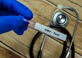 CMV serologinis tyrimas