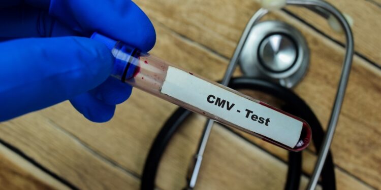CMV serologinis tyrimas