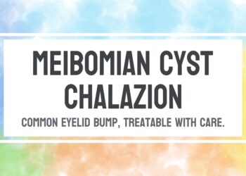 Miežis (Meibomo liaukos cista)