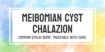 Miežis (Meibomo liaukos cista)