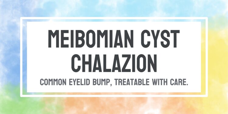 Miežis (Meibomo liaukos cista)