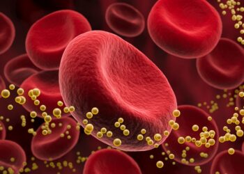 Kas yra hiperlipoproteinemija?