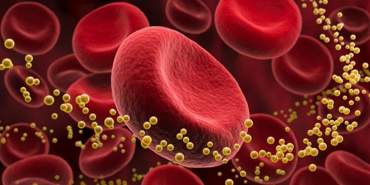 Kas yra hiperlipoproteinemija?