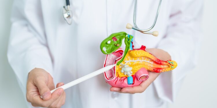 Tulžies latakų vėžio stadijos