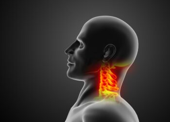 Išvaržyti diskai: kas slypi už kaklo skausmo