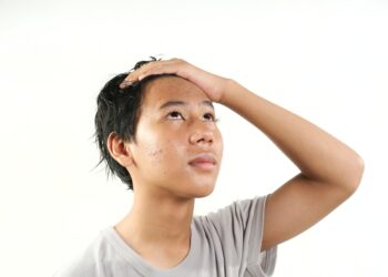 Minociklinas – veiksmingas gydymas nuo aknės?