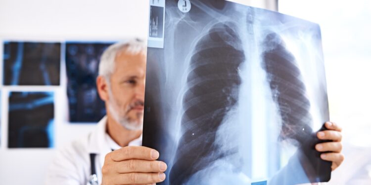 Plaučių vėžio tipai