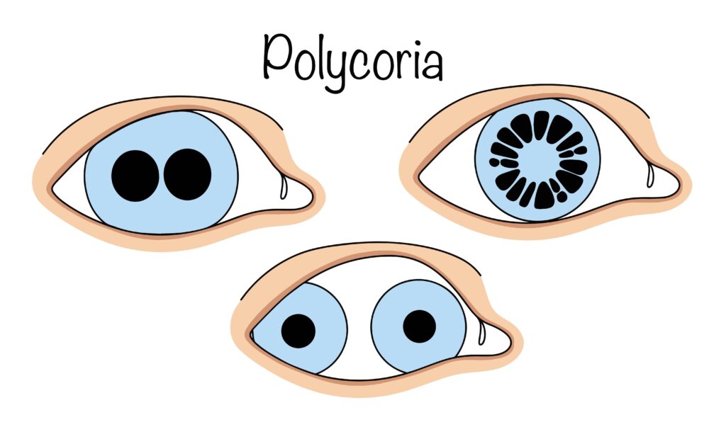 Polykorija