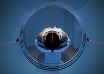 Ar PET tyrimas gali aptikti melanomą?