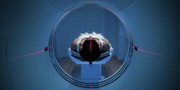 Ar PET tyrimas gali aptikti melanomą?