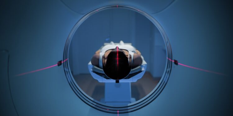 Ar PET tyrimas gali aptikti melanomą?