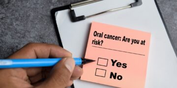 Burnos vėžys: simptomai, gydymas ir daugiau informacijos