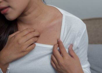 Niežtinti krūtinė