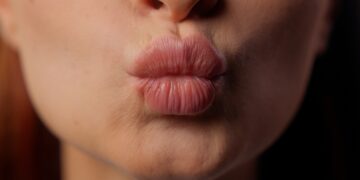 Ar bučiniai įsiurbimai gali sukelti vėžį?