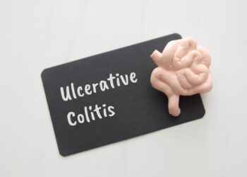 Mano UC paūmėjimas trimis žodžiais