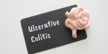 Mano UC paūmėjimas trimis žodžiais