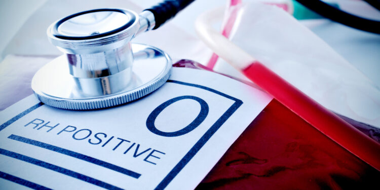 Ką reiškia turėti teigiamą (A+) kraujo grupę