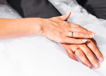 Kas yra limbaliai žiedai ir ar juos turi visi?