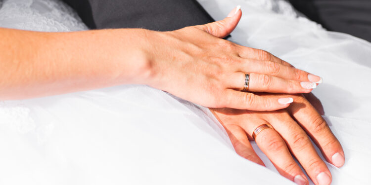 Kas yra limbaliai žiedai ir ar juos turi visi?