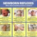 Naujagimių refleksai