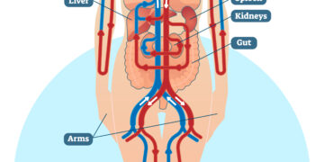 Ar egzistuoja seronegatyvinis reumatoidinis artritas?