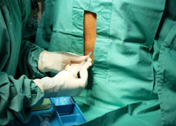 Kaip juosmens punkcija (stuburo punkcija) padeda diagnozuoti išsėtinę sklerozę?