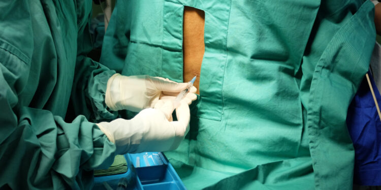 Kaip juosmens punkcija (stuburo punkcija) padeda diagnozuoti išsėtinę sklerozę?