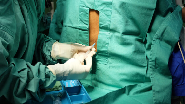 Kaip juosmens punkcija (stuburo punkcija) padeda diagnozuoti išsėtinę sklerozę?