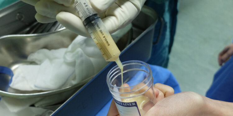 Tensilono mėginys: kas tai ir kodėl šis tyrimas JAV nebenaudojamas miastenijai gravis diagnozuoti