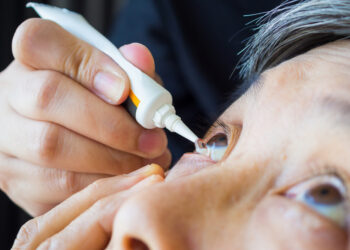 Kada reikia vartoti prednizolono akių lašus?