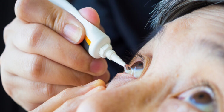 Kada reikia vartoti prednizolono akių lašus?