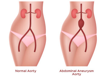 Kodėl jaučiu pulsą pilve?