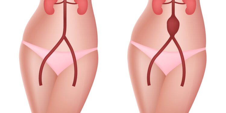 Kodėl jaučiu pulsą pilve?