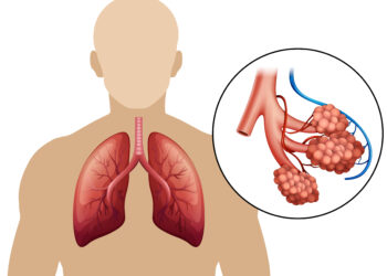 Kaip iš tikrųjų jaučiasi gyvenimas su IPF