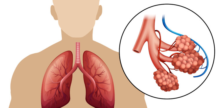 Kaip iš tikrųjų jaučiasi gyvenimas su IPF