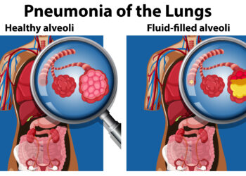 Antimitochondrinių antikūnų (AMA) tyrimas