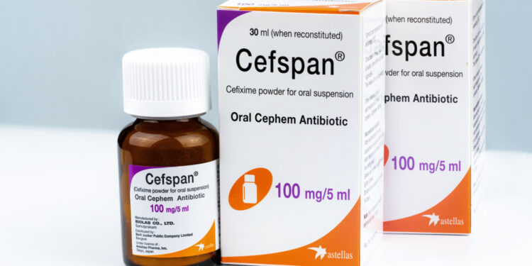 Epkinly kaina ir finansinės pagalbos galimybės