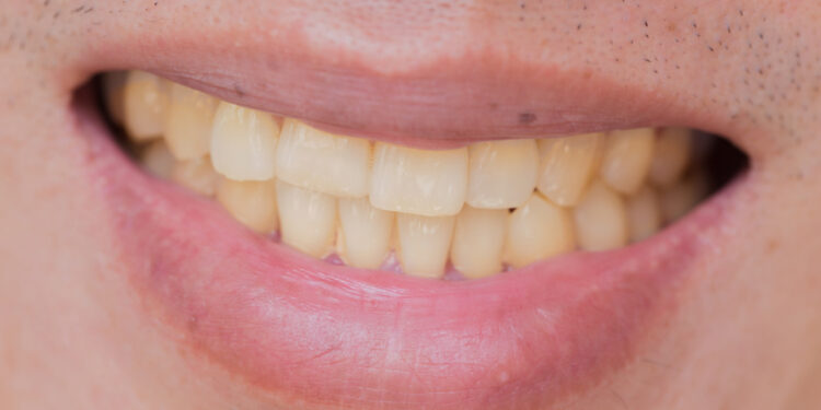 Ar kava dažo dantis?