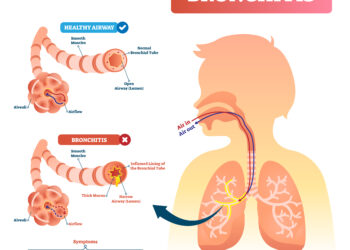Ko reikėtų vengti vartojant baklofeną?