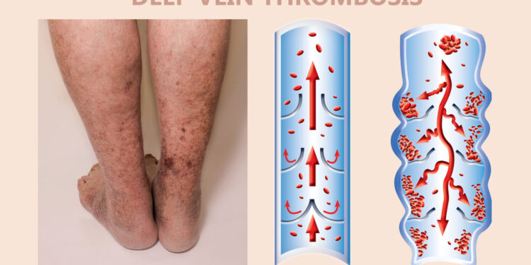 Kaip kalbuosi su savo vaikais apie psoriazę